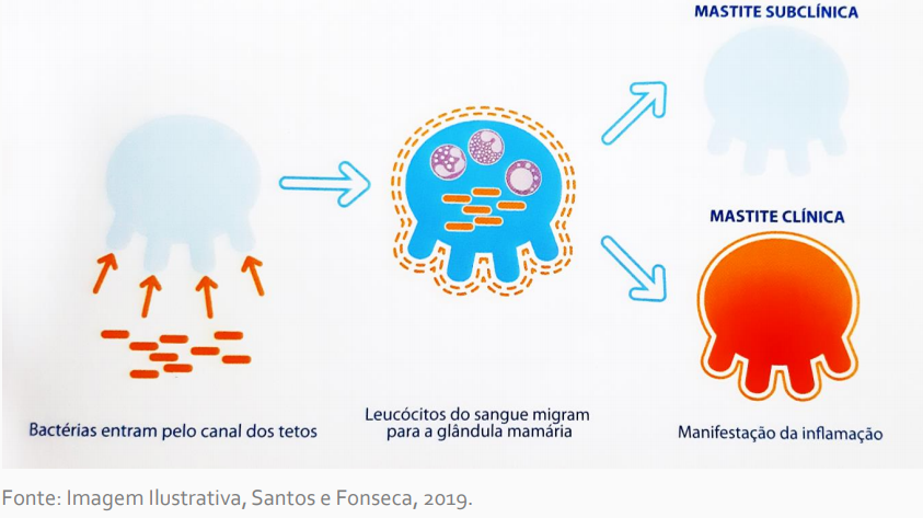 tipos de mastite